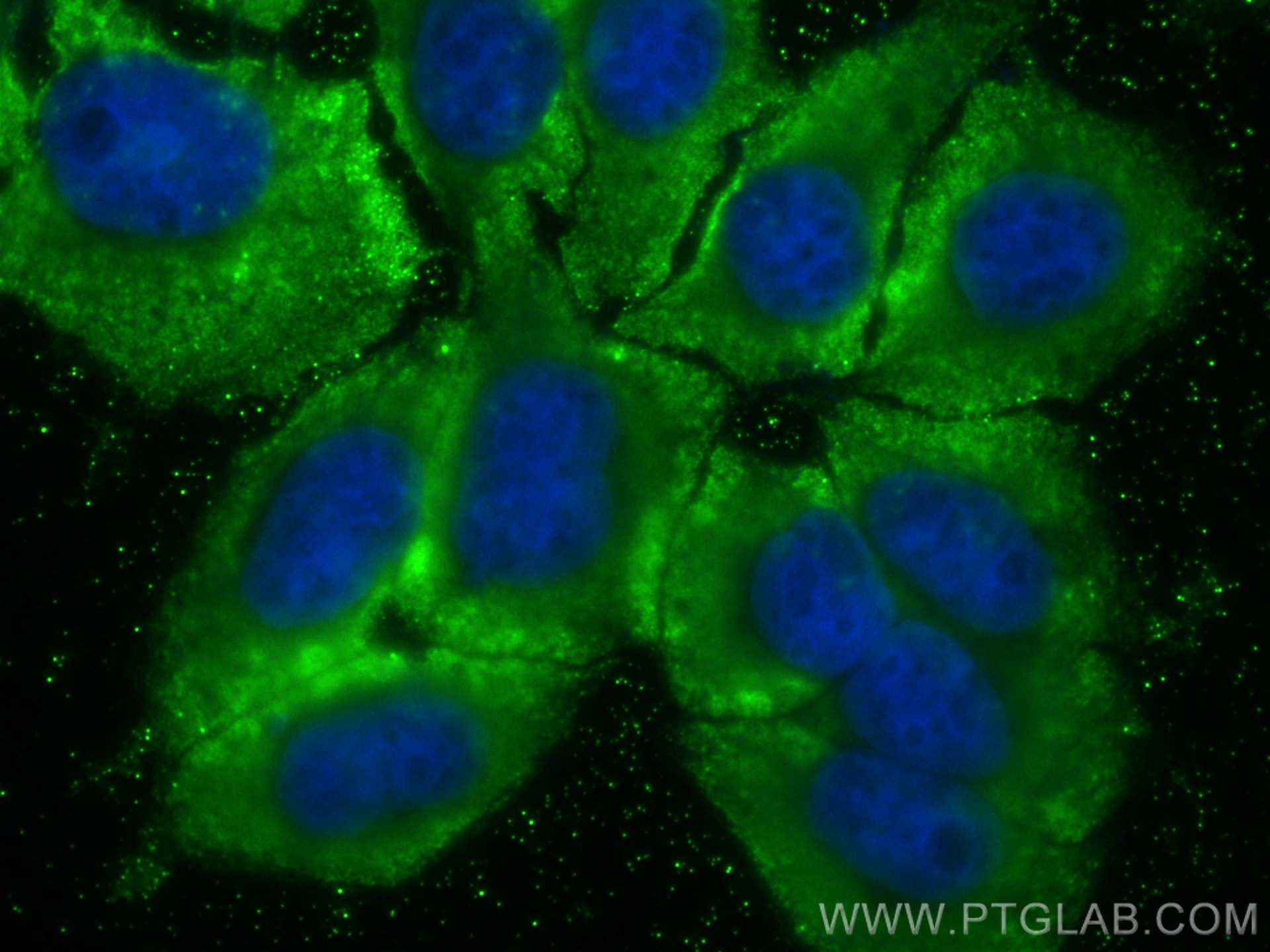 IF Staining of HepG2 using CL488-66176