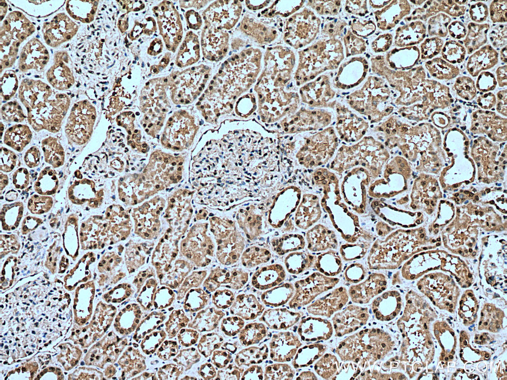 IHC staining of human kidney using 14055-1-AP