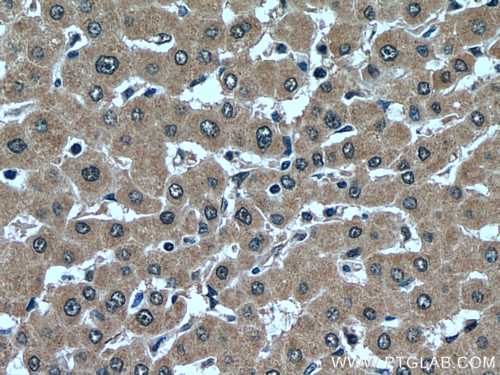 IHC staining of human liver using 14055-1-AP