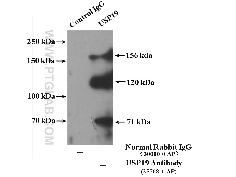 IP experiment of Jurkat using 25768-1-AP