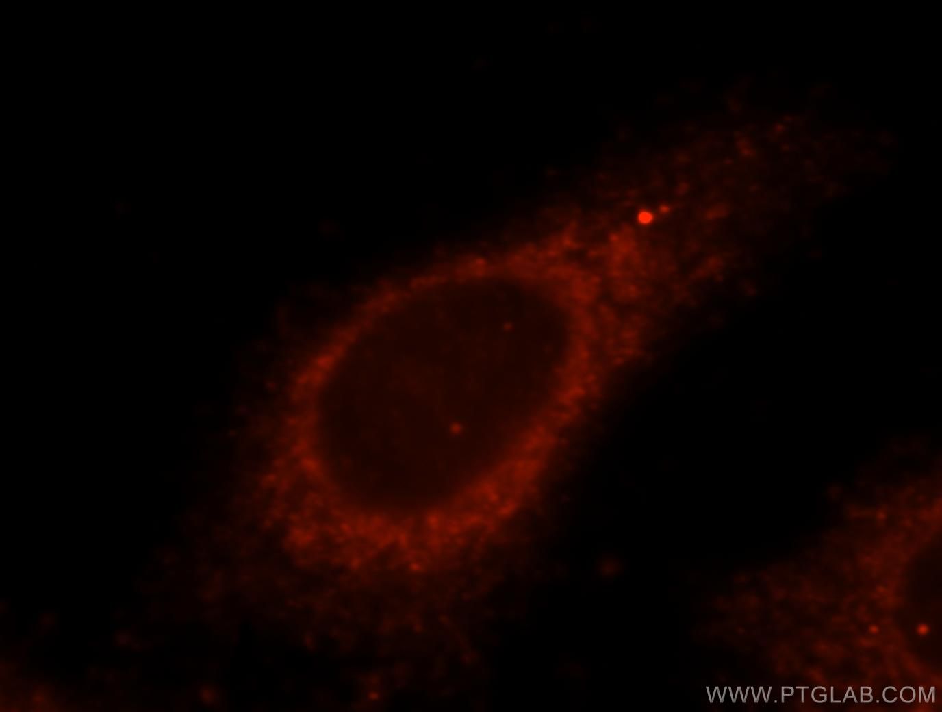 IF Staining of HepG2 using 15404-1-AP