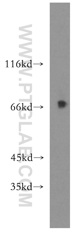 WB analysis of mouse testis using 15404-1-AP