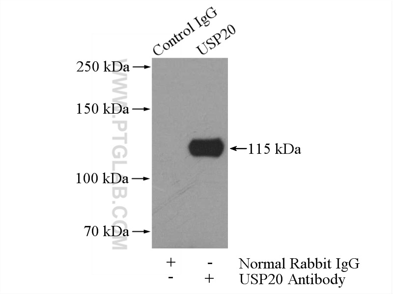 IP experiment of HeLa using 17491-1-AP