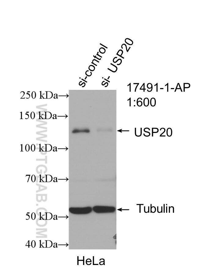 WB analysis of HeLa using 17491-1-AP