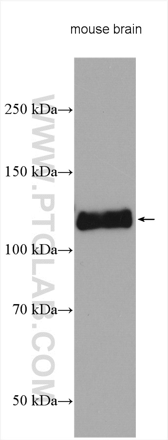 WB analysis using 17491-1-AP