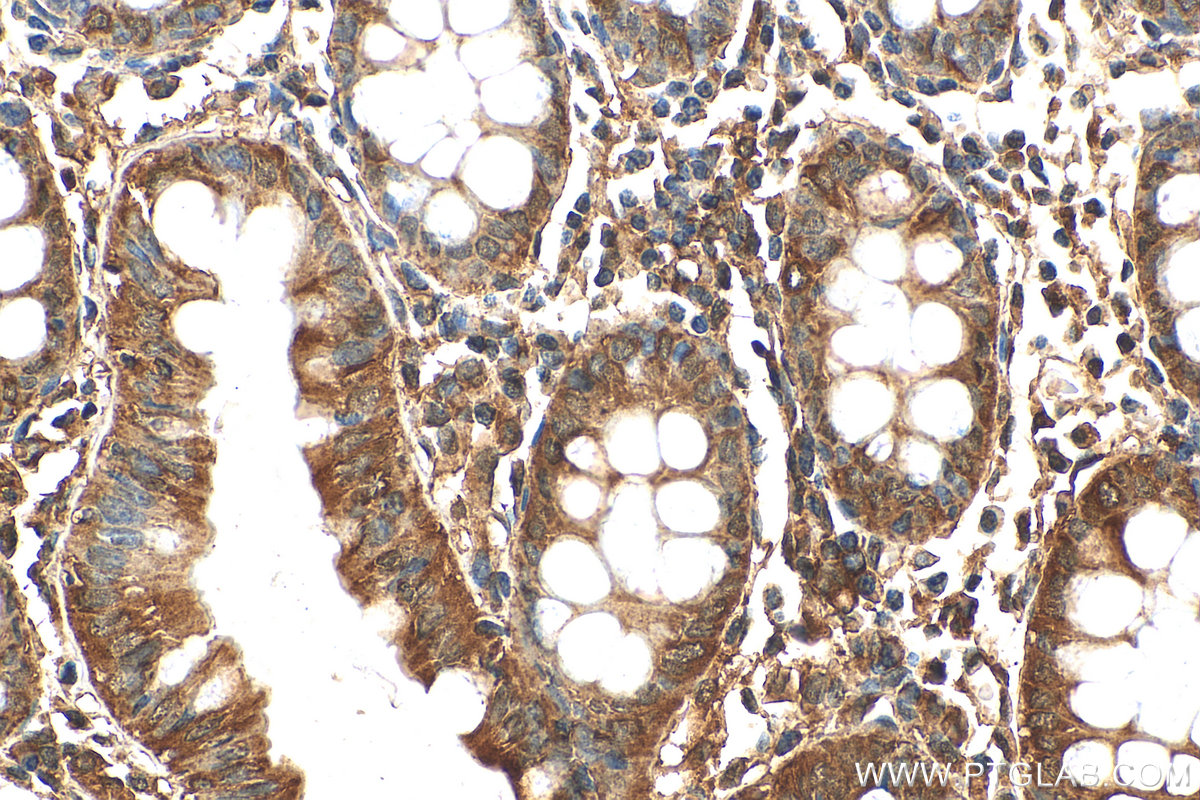 IHC staining of human colon using 28817-1-AP