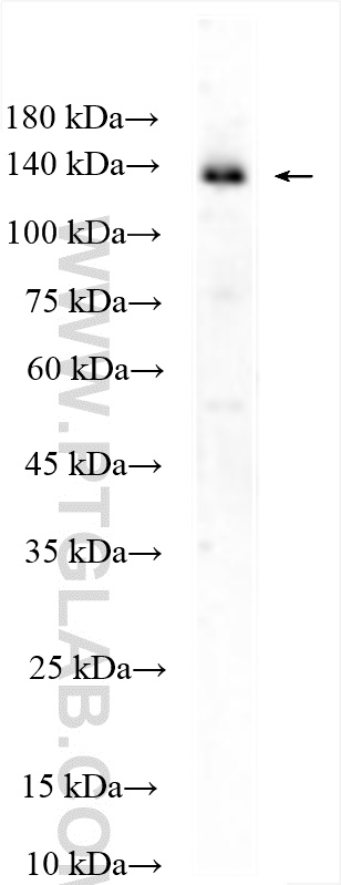 WB analysis of HEK-293T using 28817-1-AP