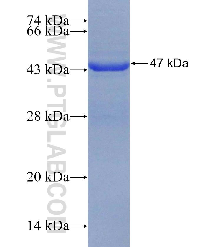 USP25 fusion protein Ag30463 SDS-PAGE