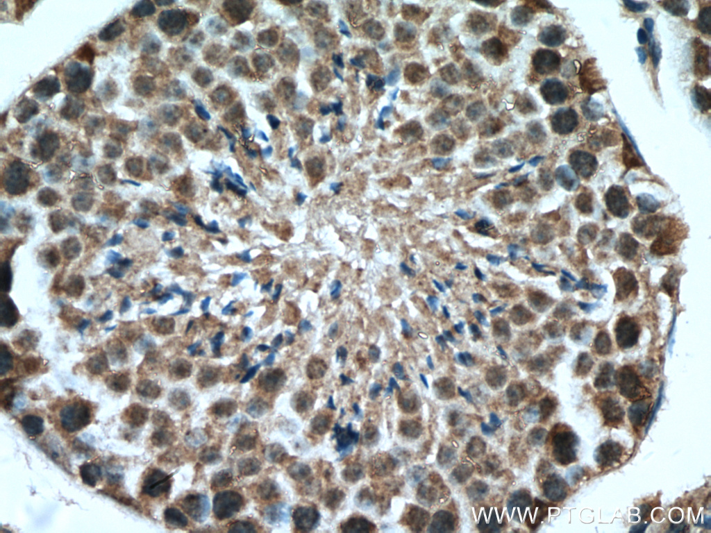 IHC staining of mouse testis using 27522-1-AP