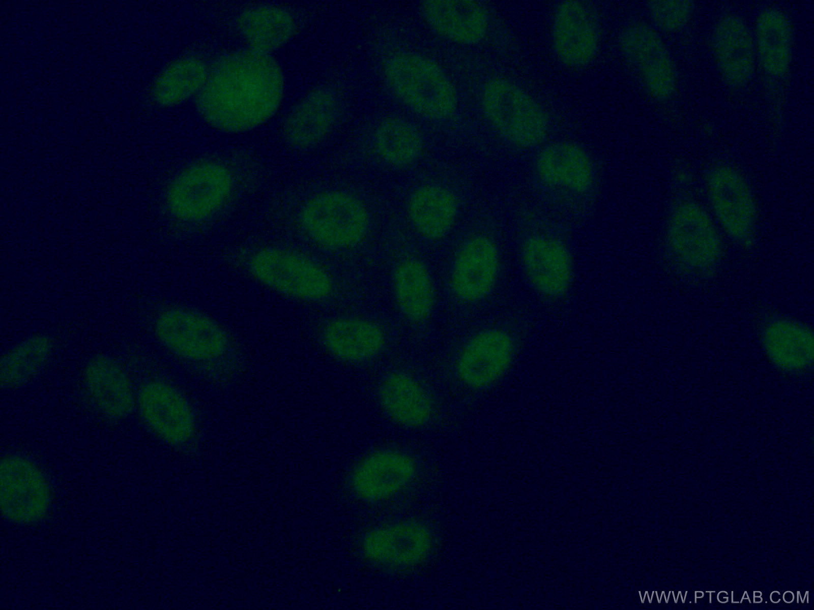 IF Staining of HepG2 using 12490-1-AP