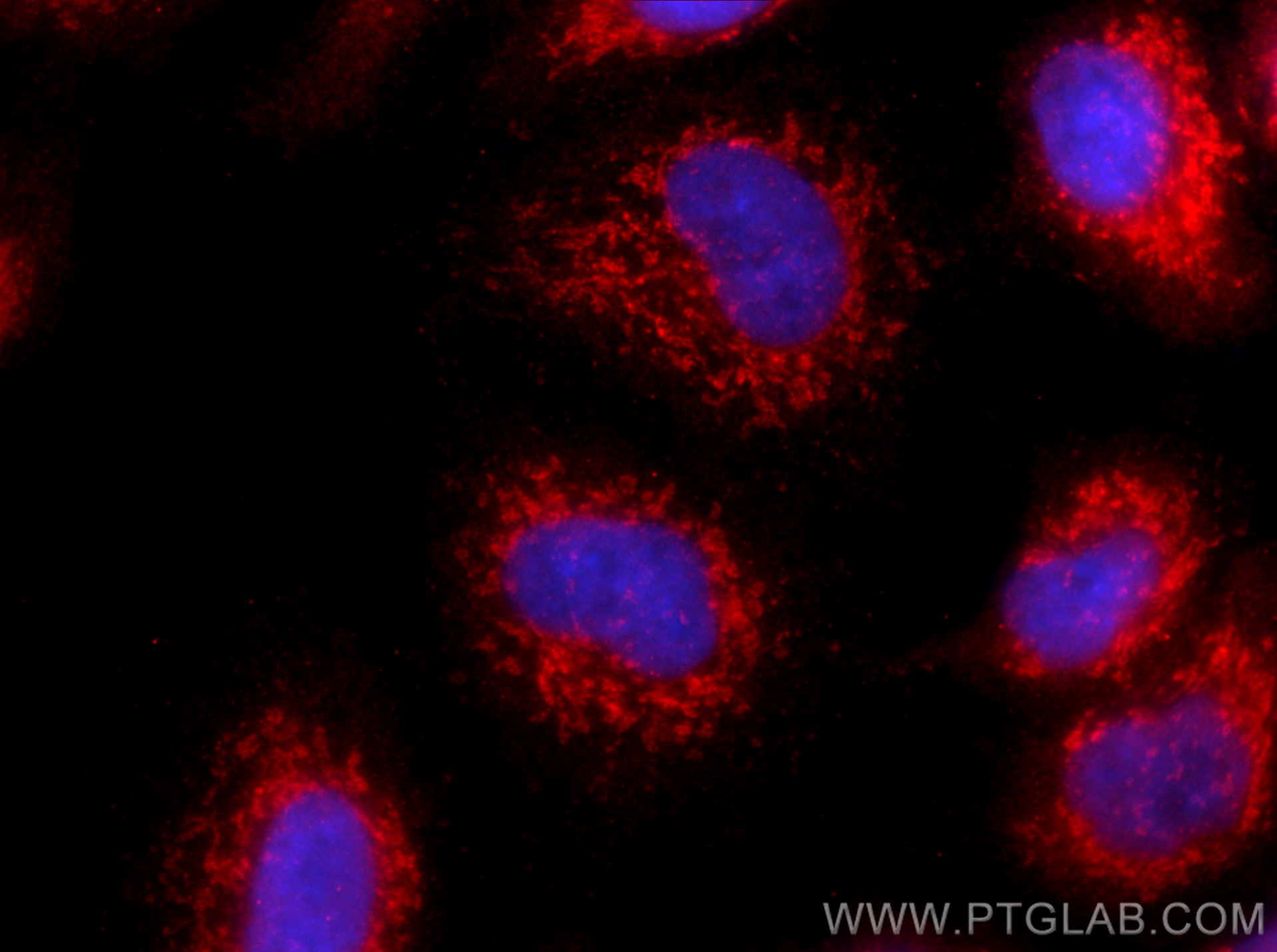 IF Staining of A549 using 15402-1-AP