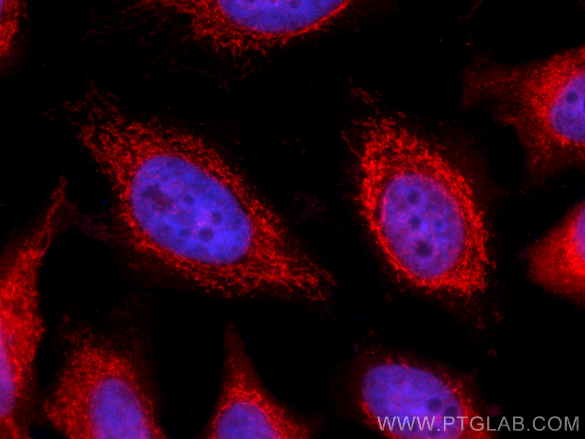 IF Staining of hela using 15402-1-AP