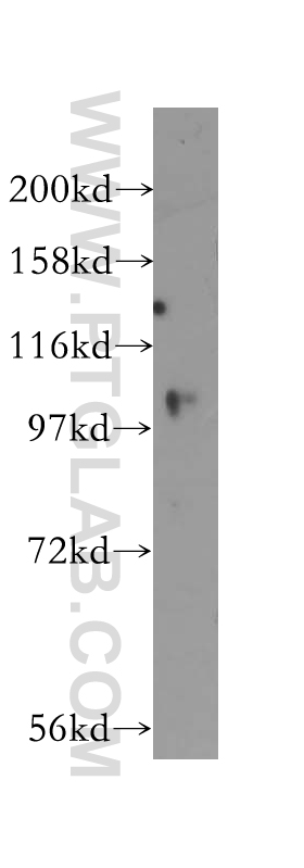 WB analysis of HEK-293 using 12060-2-AP