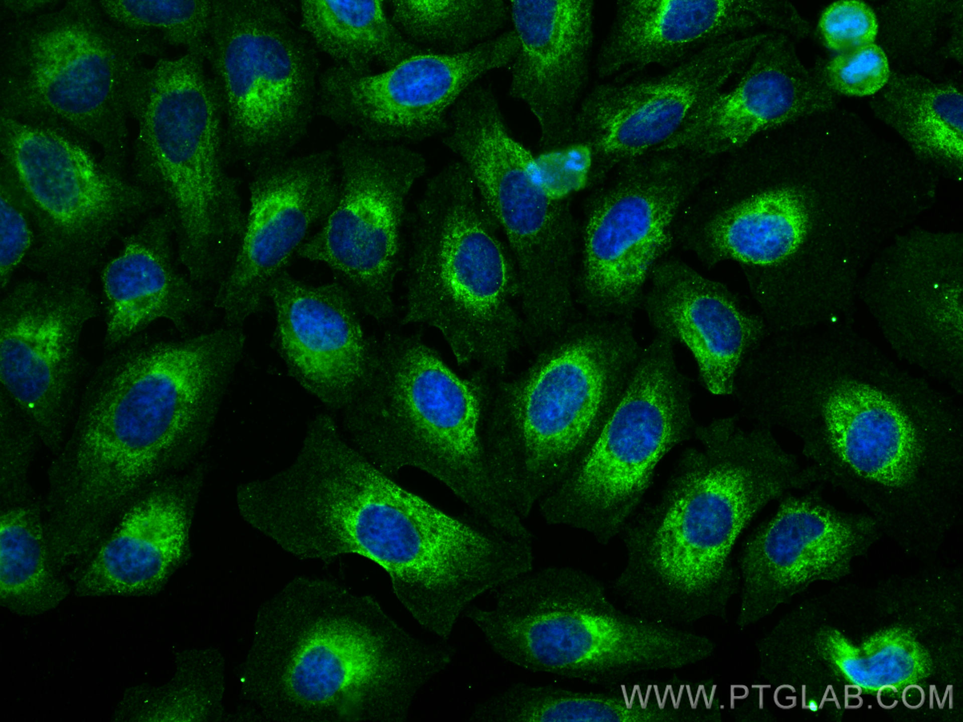 IF Staining of HeLa using 68165-1-Ig (same clone as 68165-1-PBS)