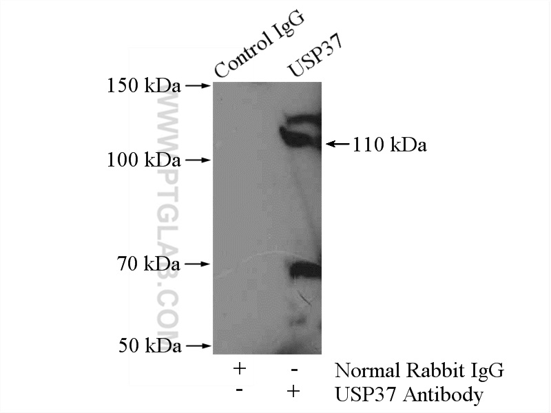 IP experiment of mouse brain using 18465-1-AP