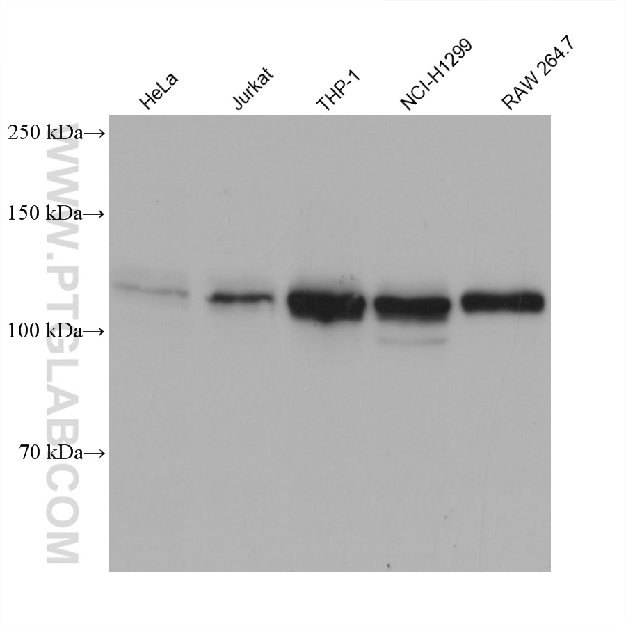 WB analysis using 66822-1-Ig (same clone as 66822-1-PBS)