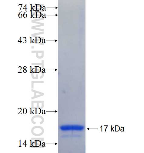 USP4 fusion protein Ag25973 SDS-PAGE