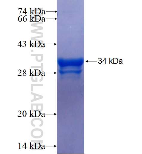 USP4 fusion protein Ag25980 SDS-PAGE