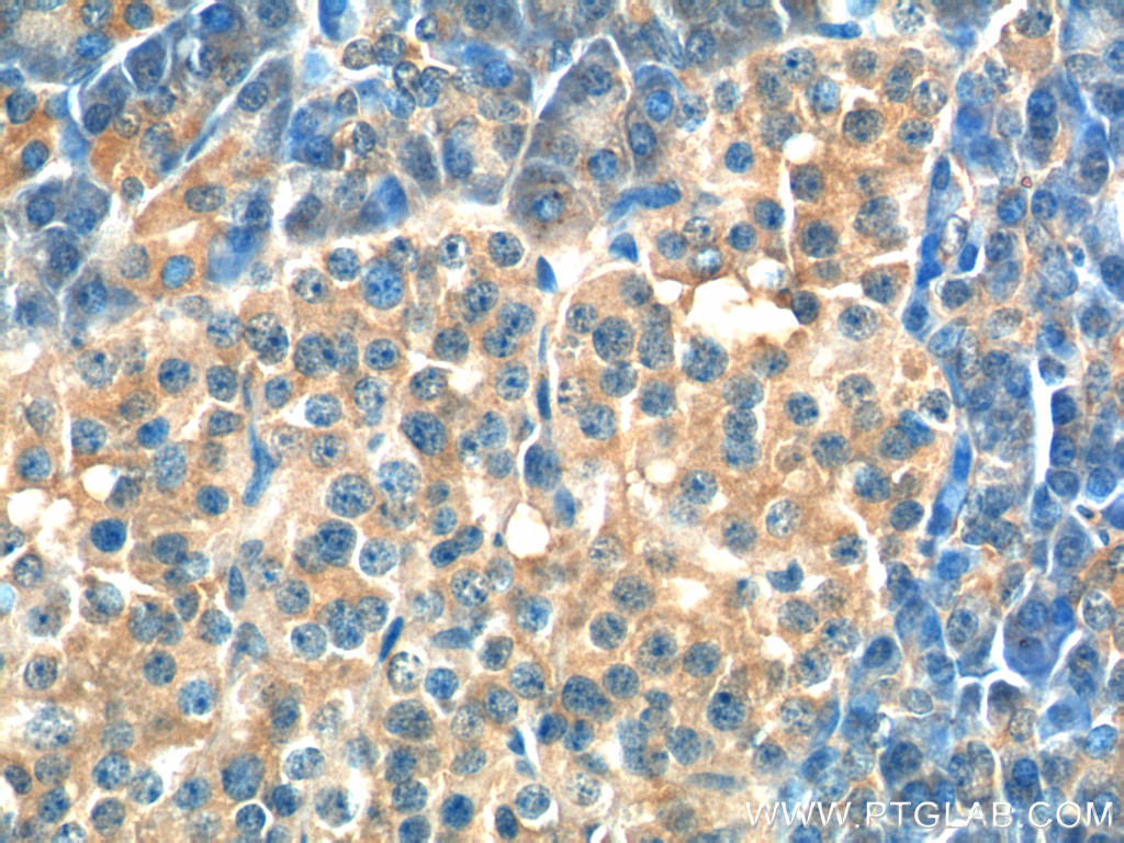 IHC staining of human pancreas using 13502-1-AP