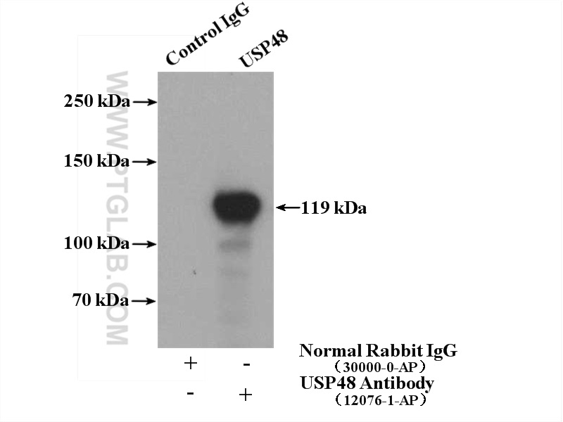 IP experiment of HeLa using 12076-1-AP