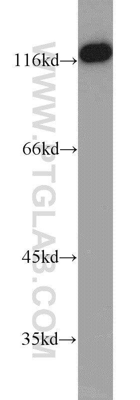 WB analysis of PC-3 using 12076-1-AP