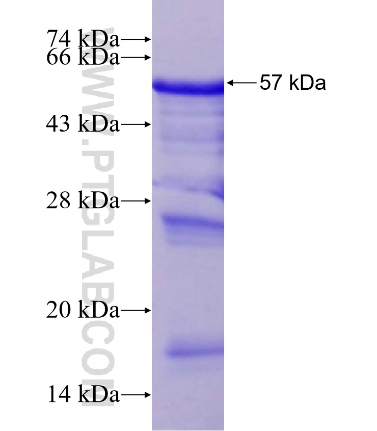 USP48 fusion protein Ag2749 SDS-PAGE