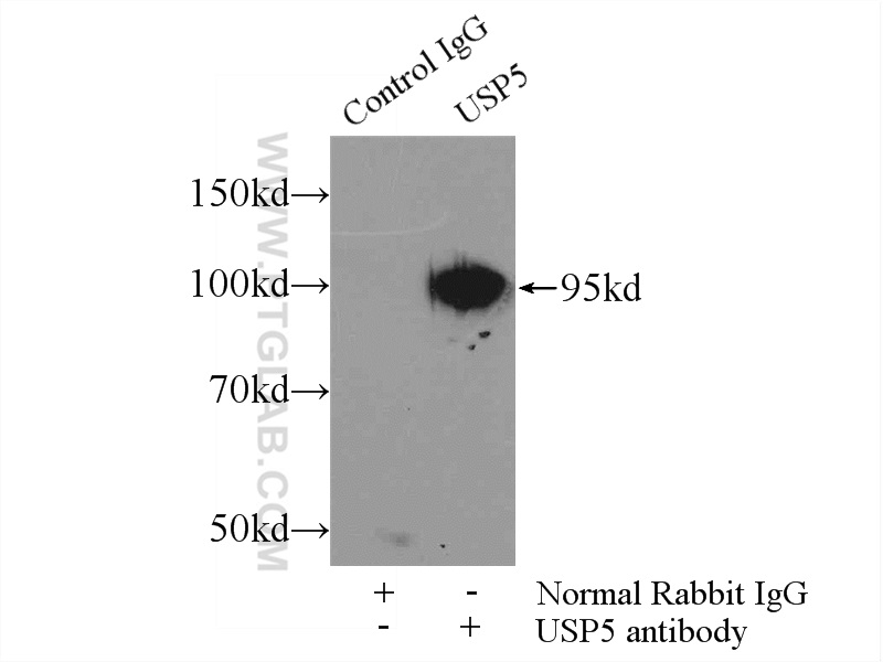 IP experiment of mouse brain using 15158-1-AP