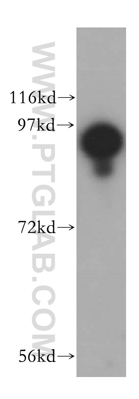 WB analysis of mouse lung using 15158-1-AP