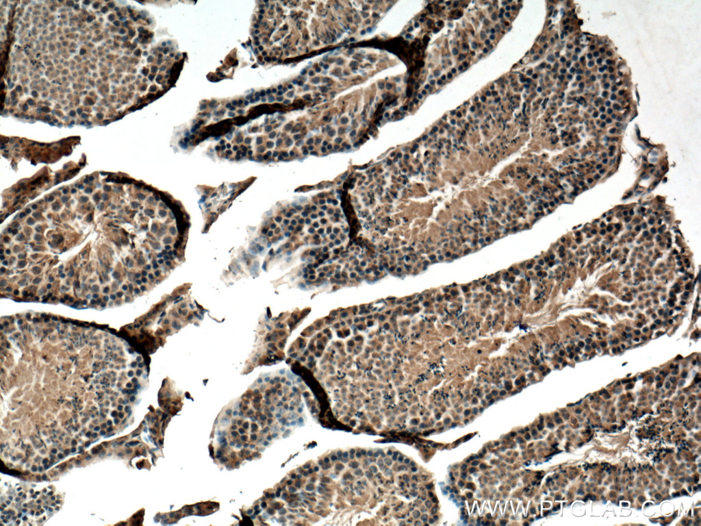 IHC staining of mouse testis using 20374-1-AP