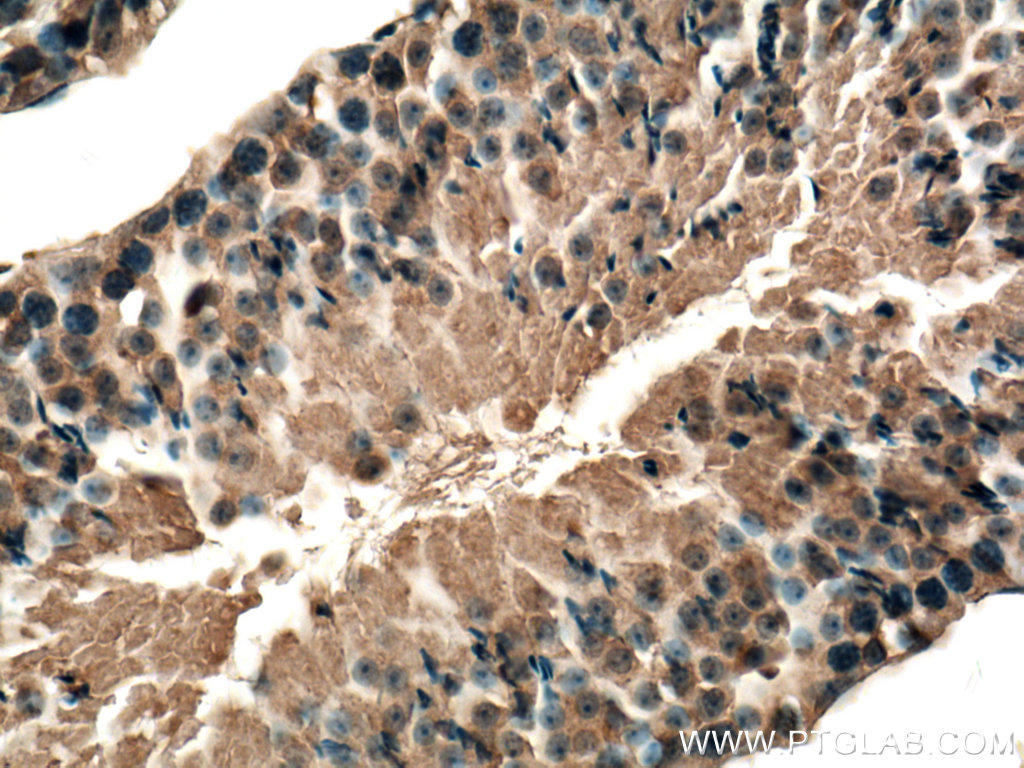 IHC staining of mouse testis using 20374-1-AP