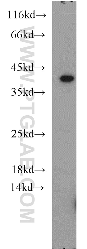 WB analysis of mouse brain using 20374-1-AP