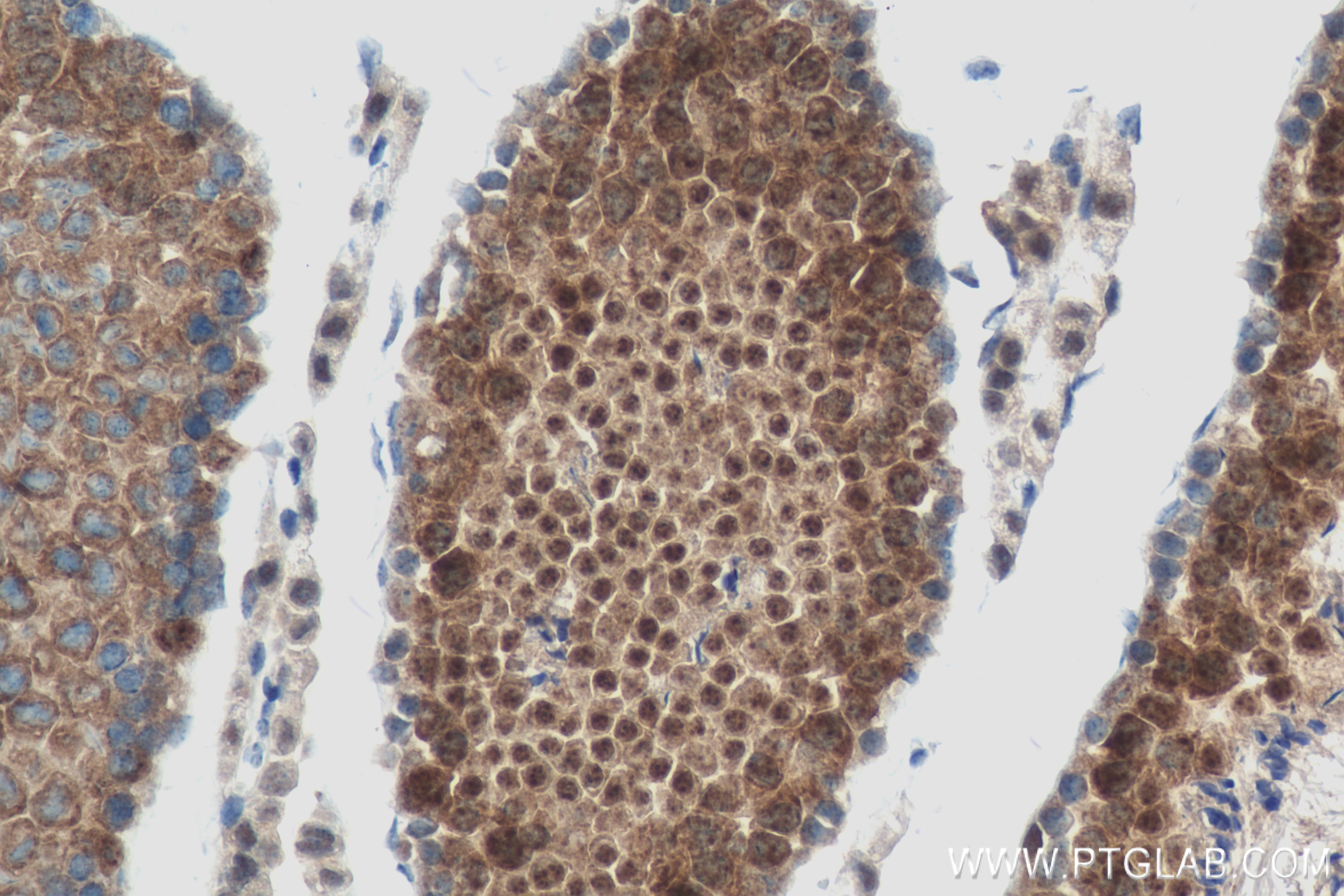 IHC staining of mouse testis using 83846-1-RR