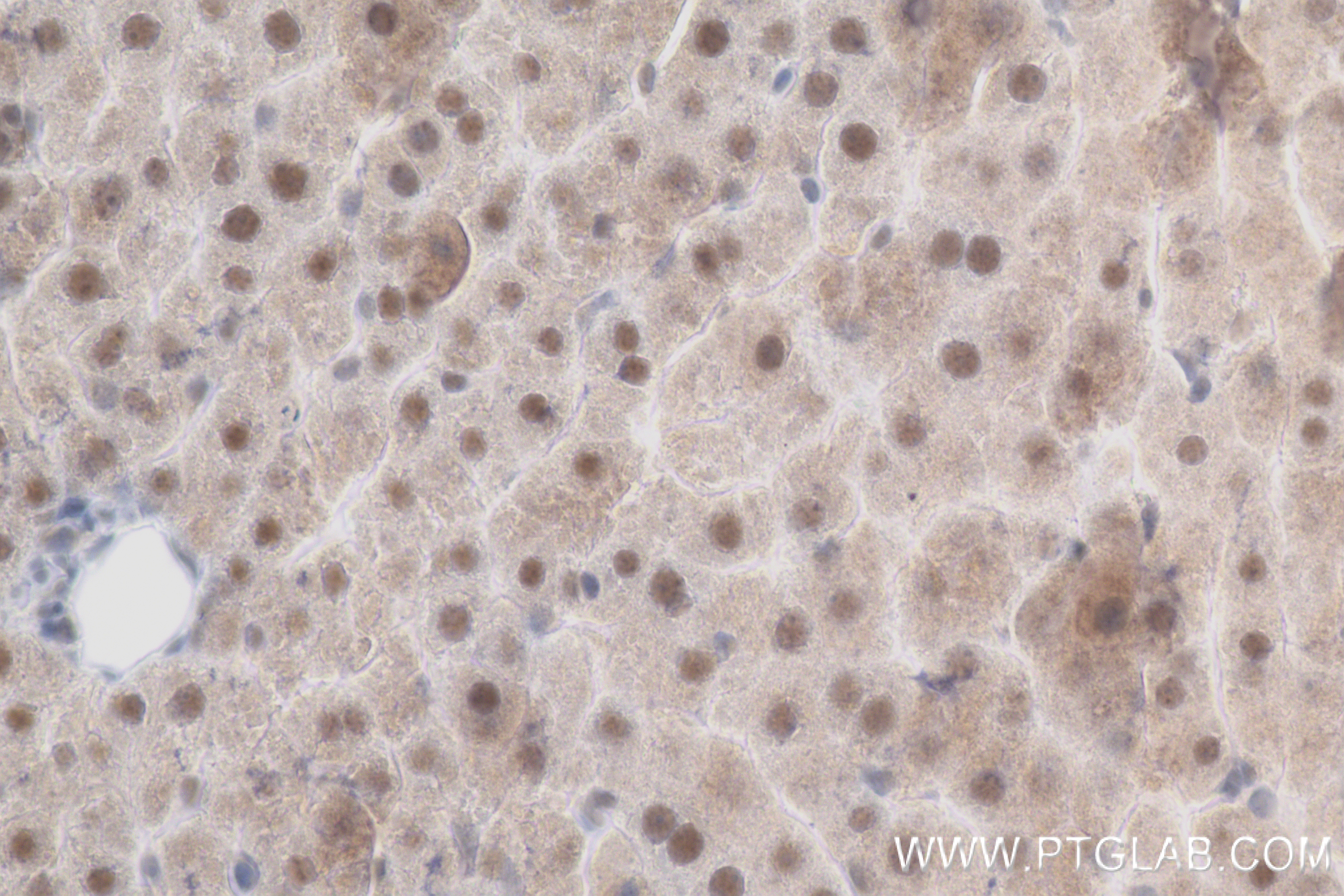 IHC staining of rat liver using 83846-1-RR