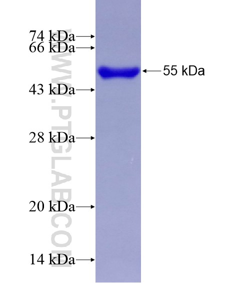 USP53 fusion protein Ag28923 SDS-PAGE