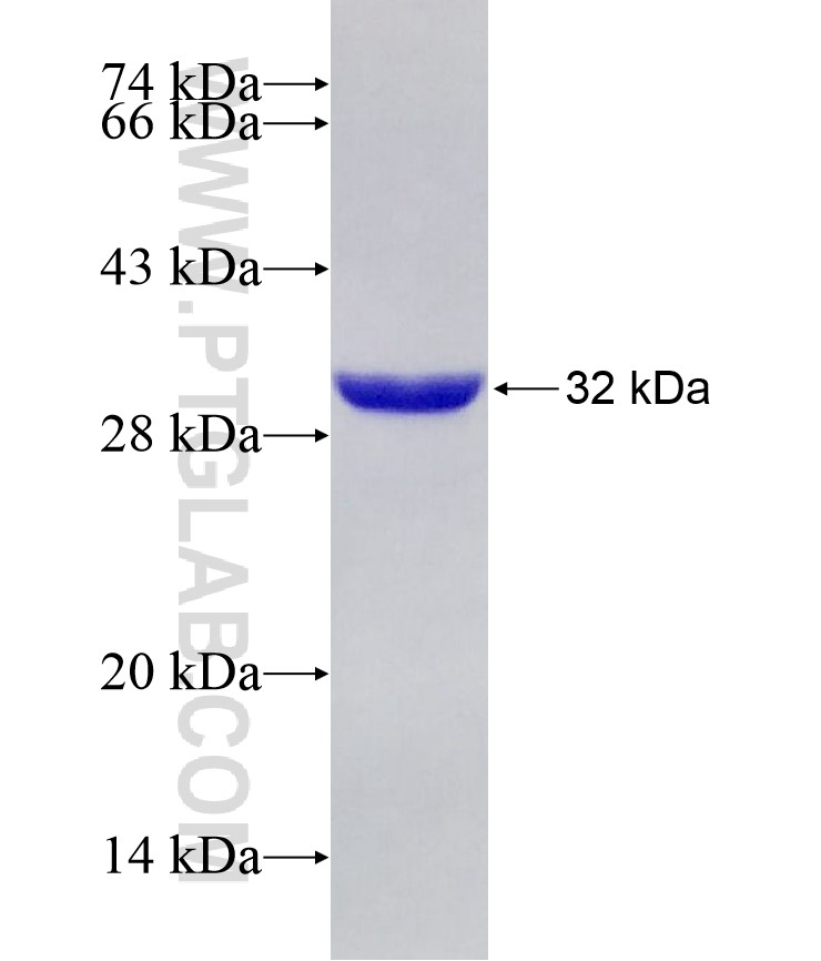 USP53 fusion protein Ag29094 SDS-PAGE