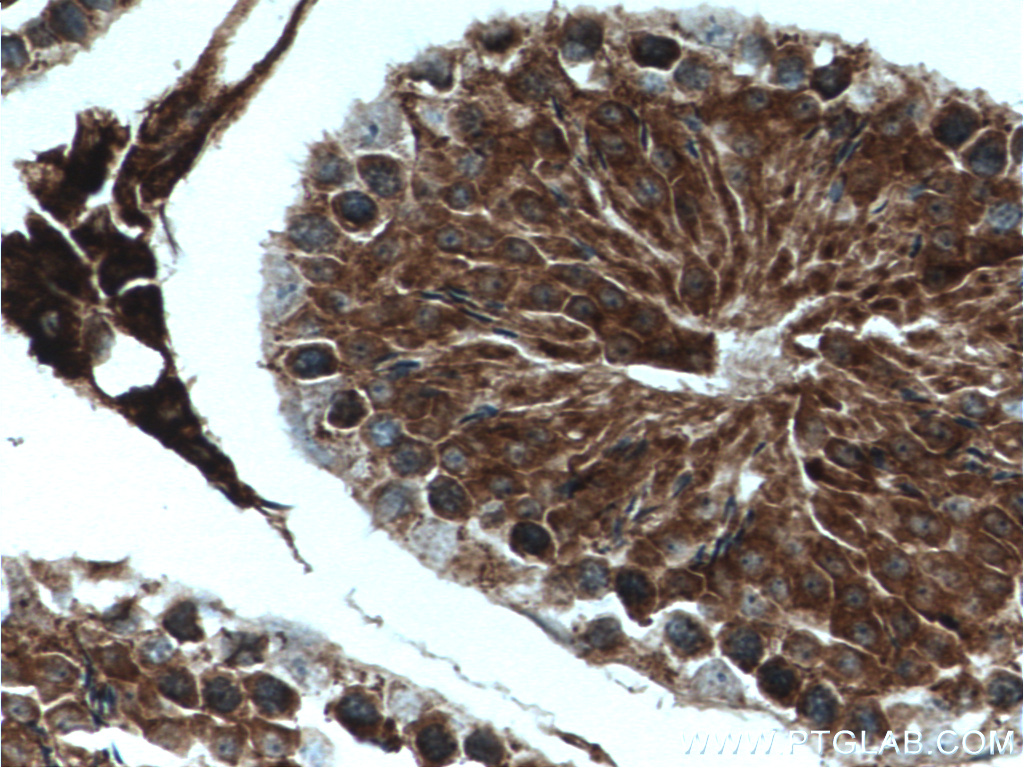 IHC staining of mouse testis using 27791-1-AP