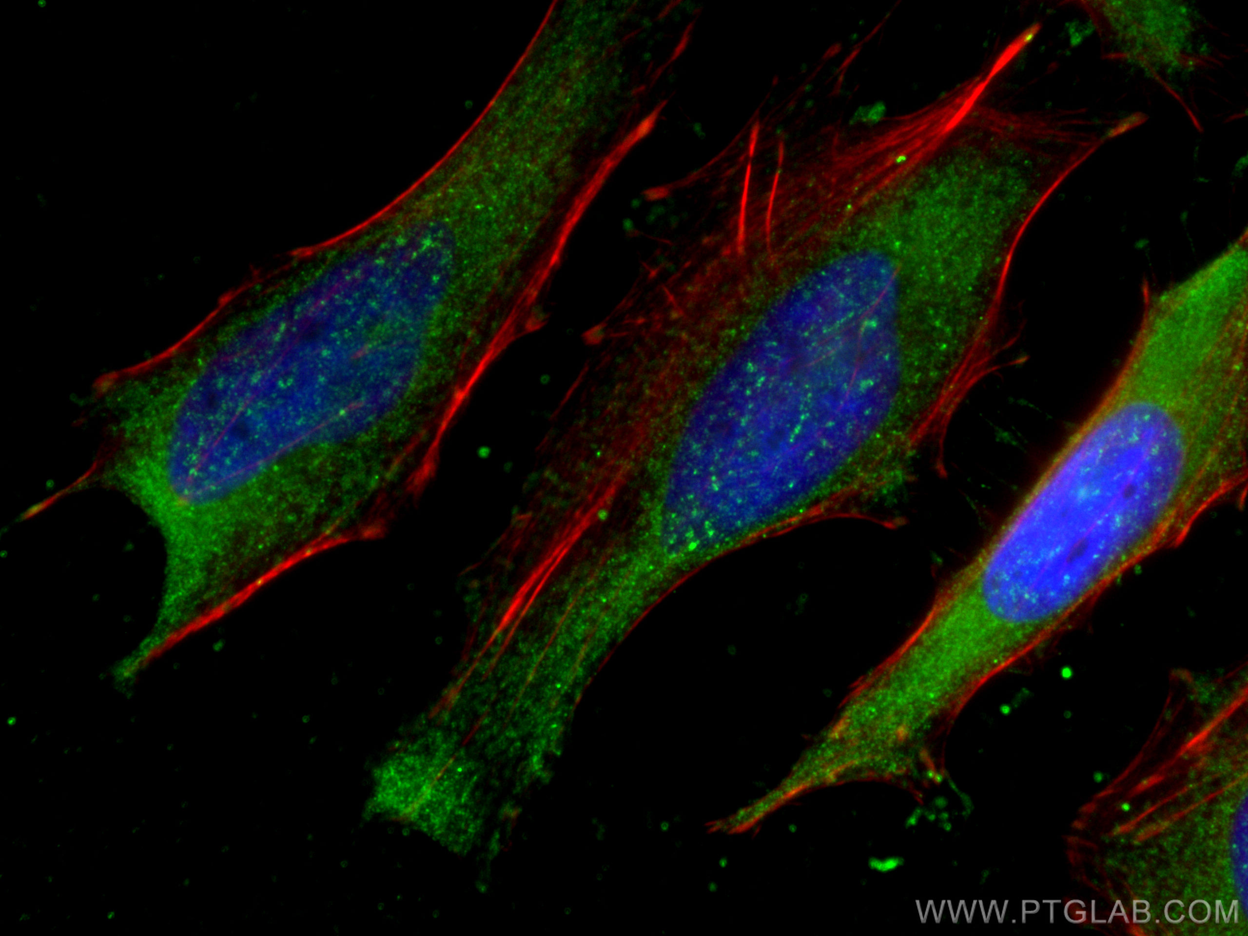 IF Staining of HeLa using 67321-1-Ig (same clone as 67321-1-PBS)