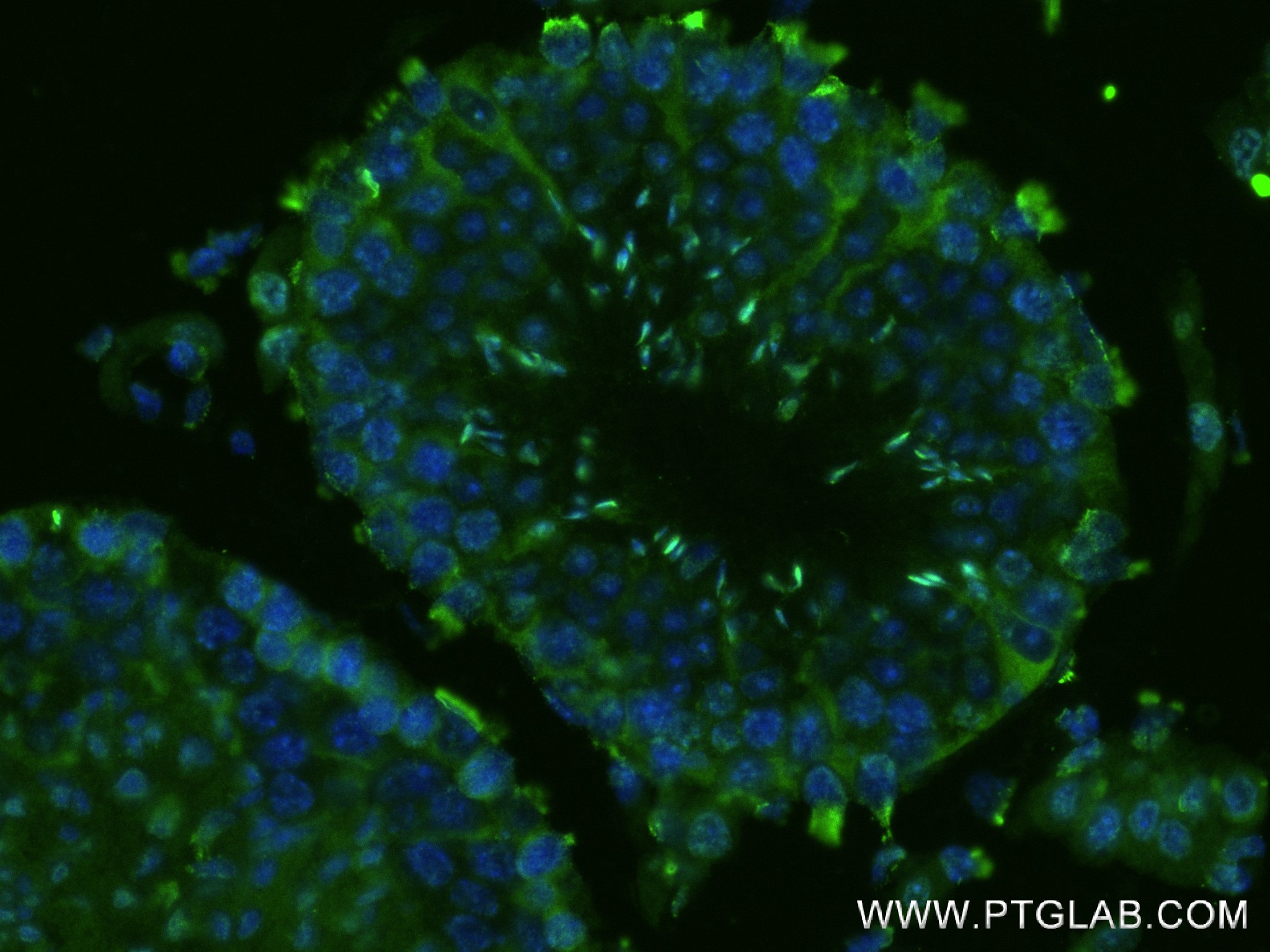 IF Staining of mouse testis using 81892-1-RR (same clone as 81892-1-PBS)