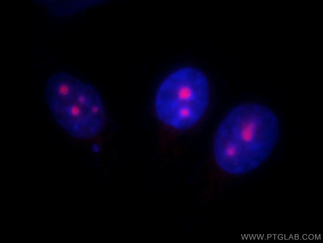 IF Staining of HepG2 using 11474-1-AP