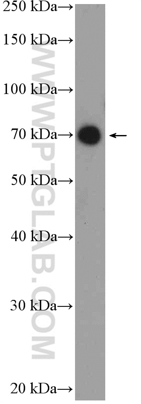 WB analysis of HeLa using 17671-1-AP