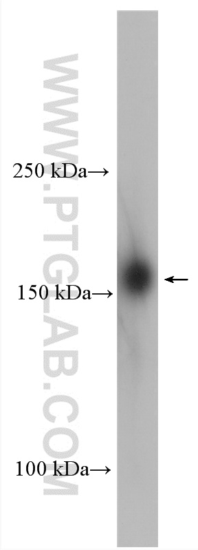 WB analysis of COLO 320 using 23984-1-AP