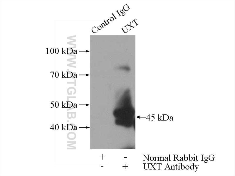 IP experiment of mouse brain using 11047-1-AP