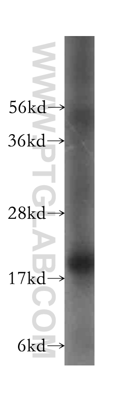 WB analysis of HeLa using 11047-1-AP