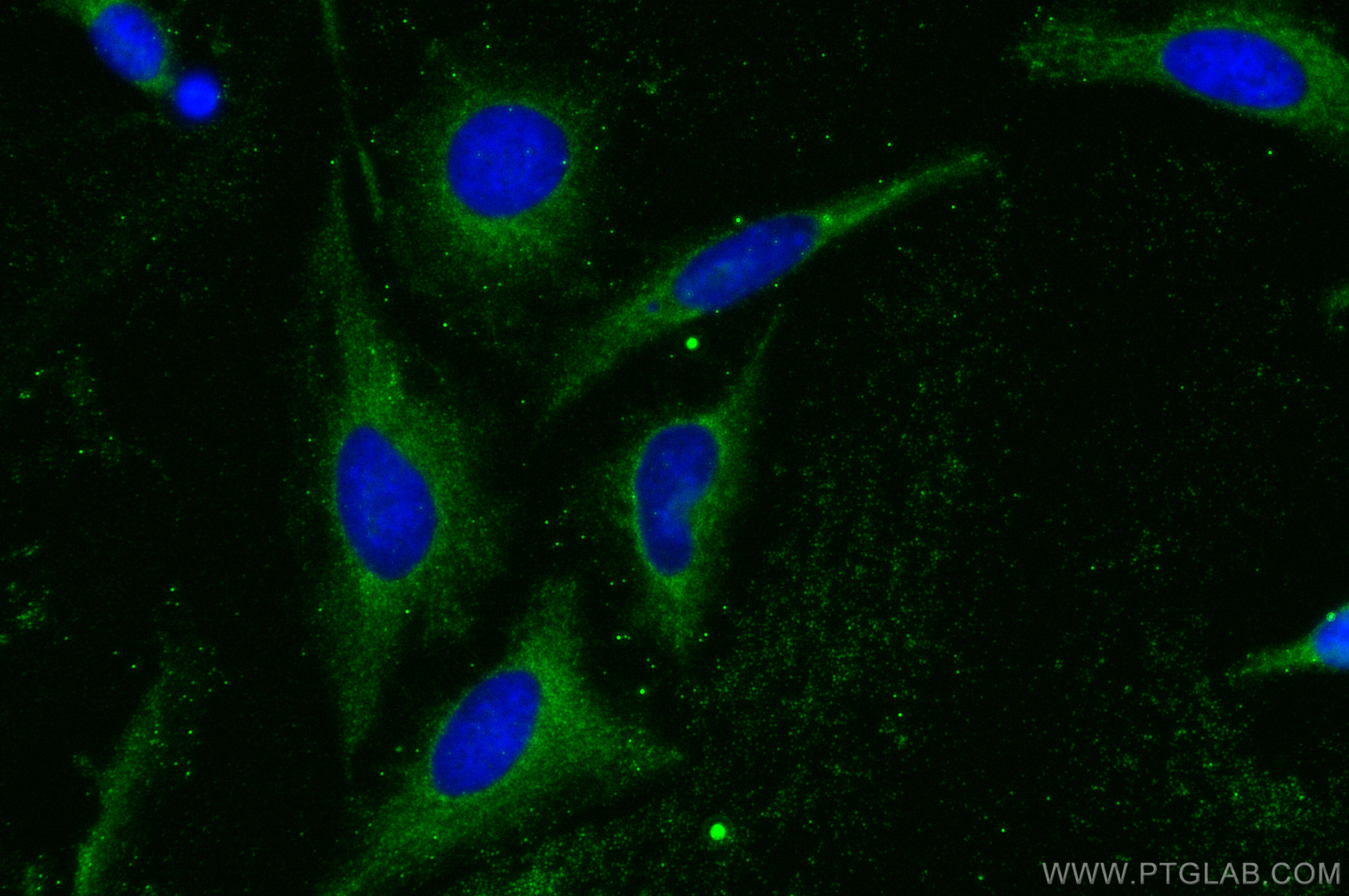 IF Staining of HeLa using 22126-1-AP (same clone as 22126-1-PBS)