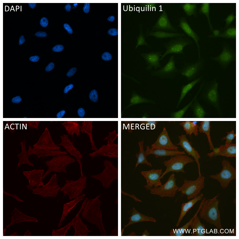 IF Staining of HeLa using 84649-2-RR