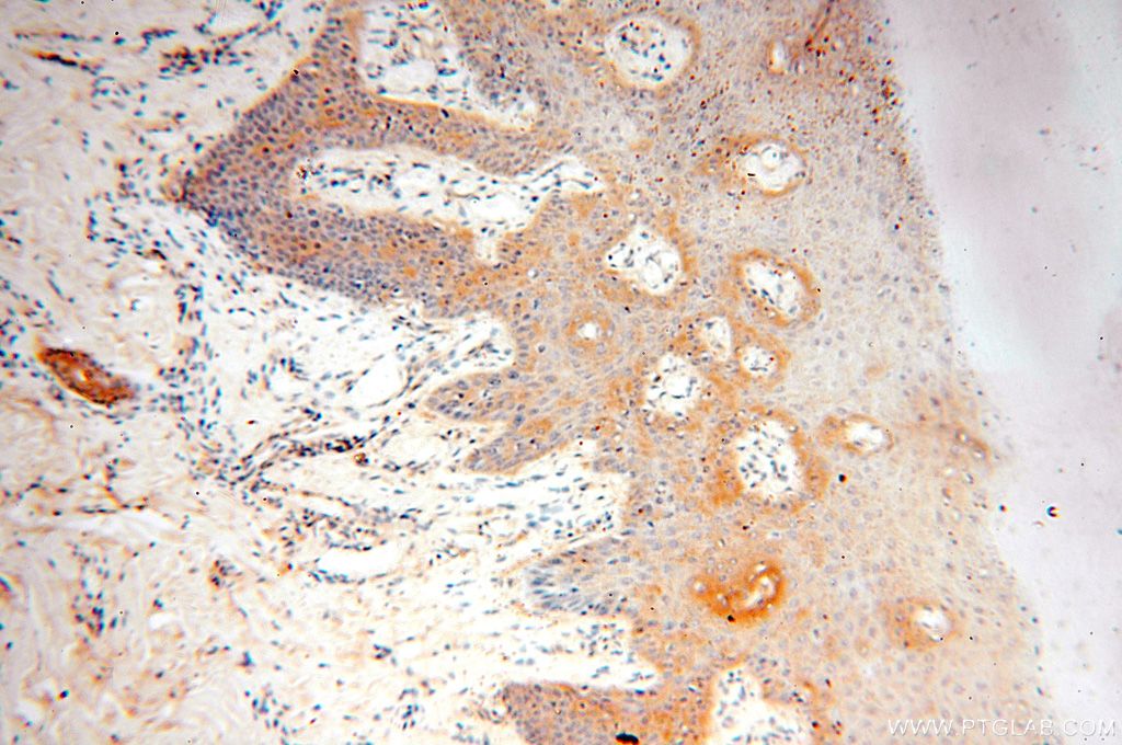 IHC staining of human skin using 15771-1-AP