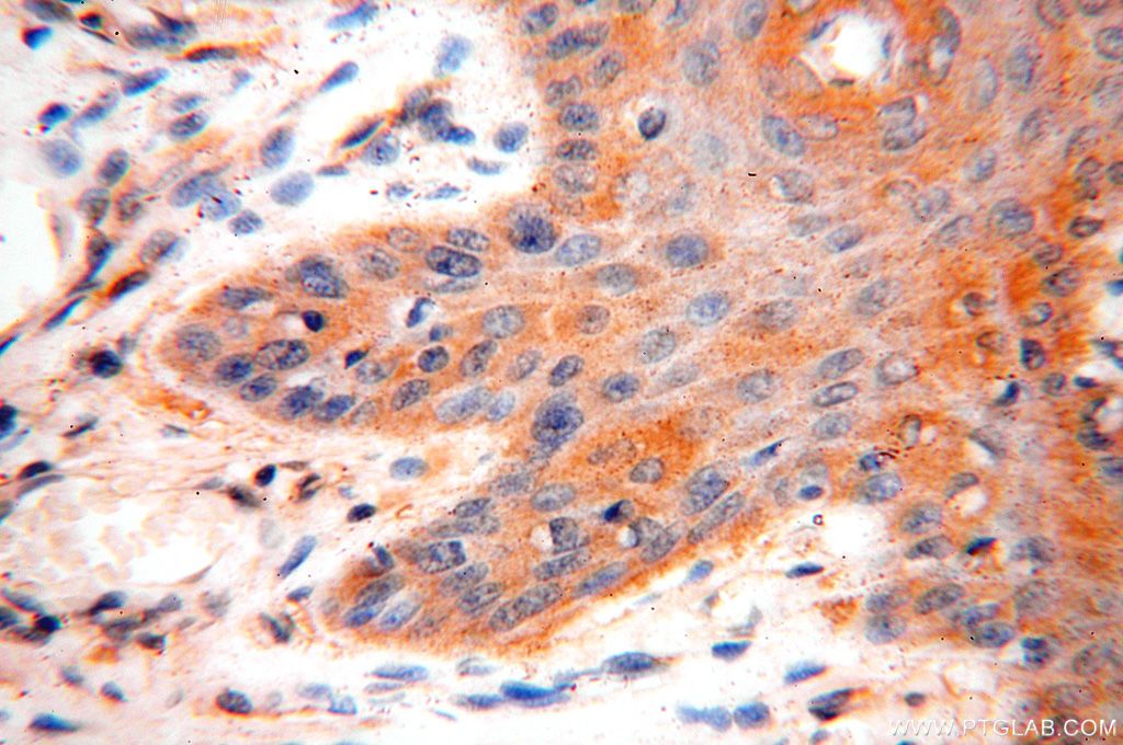 IHC staining of human skin using 15771-1-AP