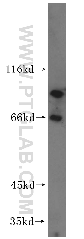 WB analysis of human spleen using 15771-1-AP