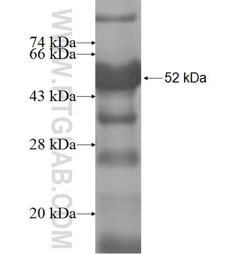 VAC14 fusion protein Ag8415 SDS-PAGE