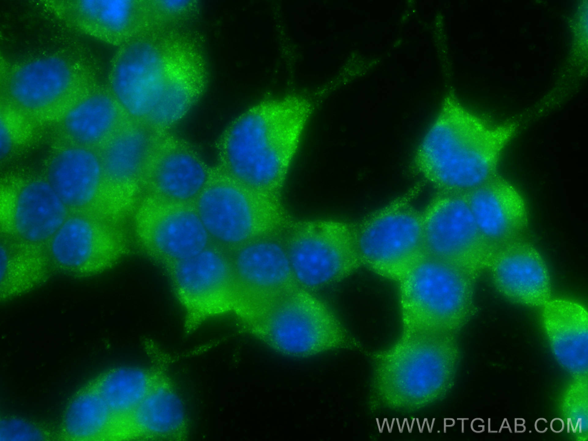 IF Staining of Neuro-2a using 66488-1-Ig (same clone as 66488-1-PBS)